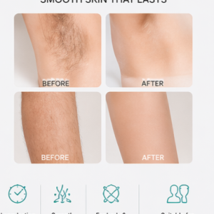 IPL Epilator