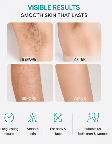 IPL Epilator